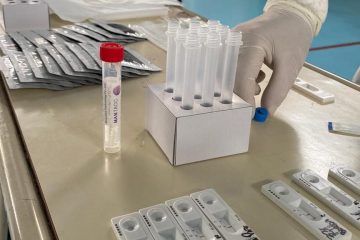 En Santa Cruz ahora se realizan más testeos y baja la tasa de incidencia:  sobre 1524 muestras se detectaron 281 contagios